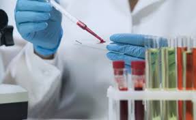 Virus de Inmunodeficiencia Adquirida (VIH), sida (Foto archivo agencias)