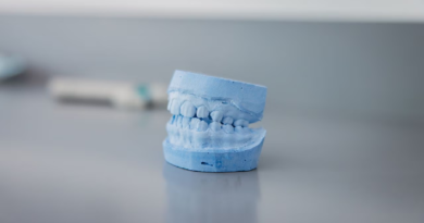 Estos son los consejos para cuidar los dientes de los niños