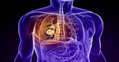 Estos son los principales síntomas para detectar cáncer de pulmón