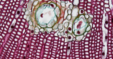Descubren el detonador que acabaría con las células cancerígenas