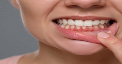 Diez mitos de la salud de las encías